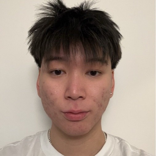 Moi